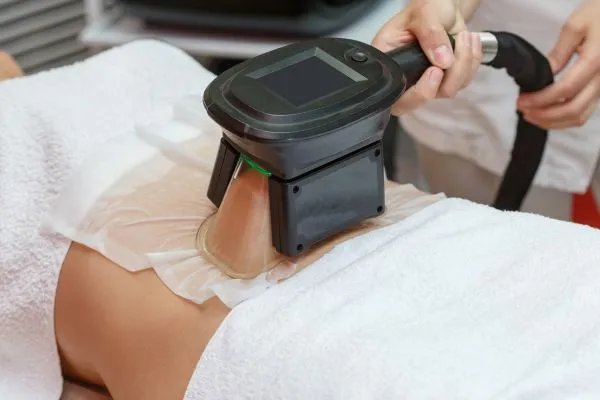 Image of person having fat freezing treatment to help weight gain Rushden