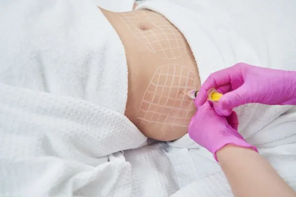 image of fat dissolving injections on love handles to help combat weight gain Rushden