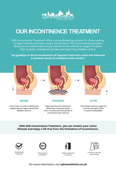 image of how urge incontinence Rushden treatment works