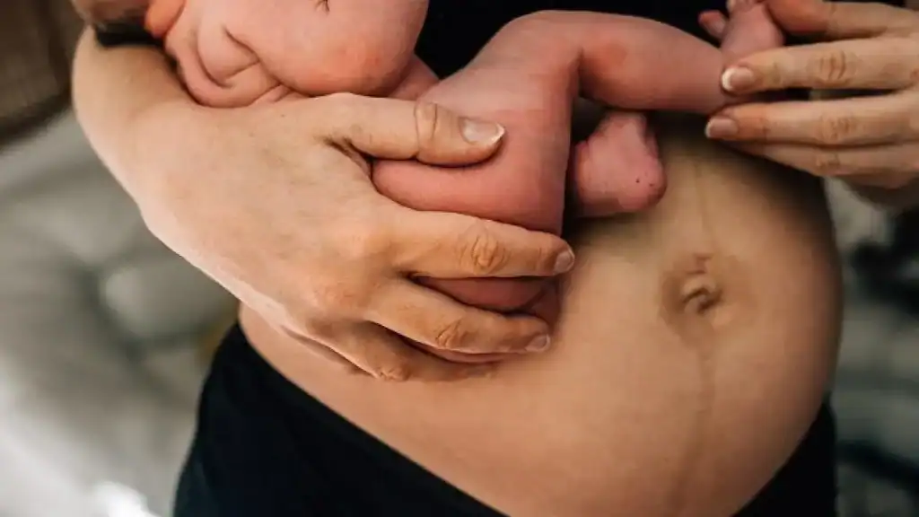 Why Is My Stomach Still Big After Pregnancy Rushden?